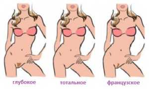 Шугаринг бикини: что нужно знать о процедуре