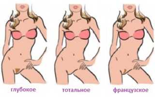 Шугаринг бикини: что нужно знать о процедуре