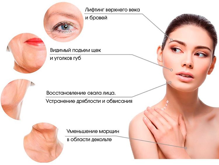 Эффект от ультразвуковой подтяжки лица