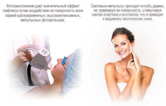 Описание принципа действия фотоомоложения
