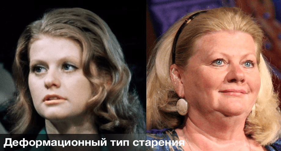 Деформационный тип старения