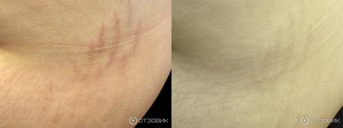 Фото до и после
