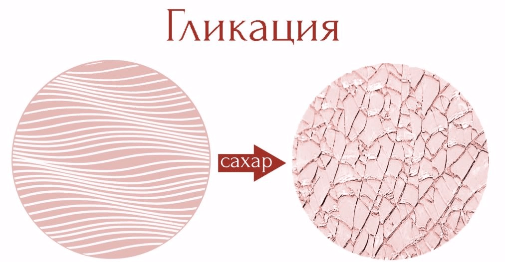гликирование кожи