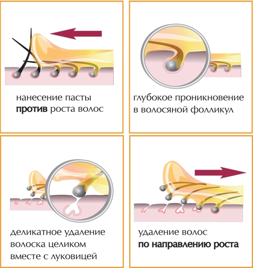 Как проводить шугаринг