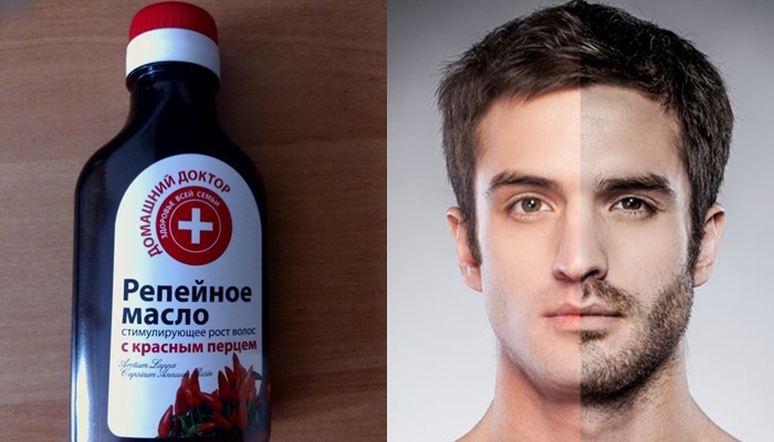 Коллаж: репейное масло и бородач