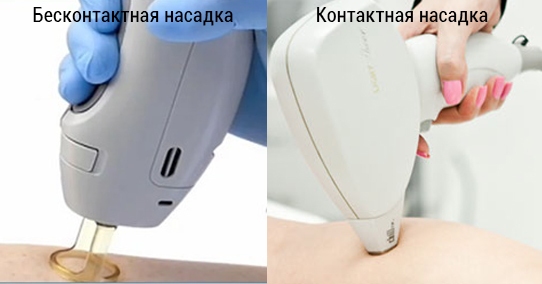 Контактная и бесконтактная насадка лазера