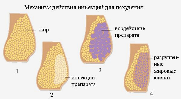 Механизм действия антицеллюлитных инъекций