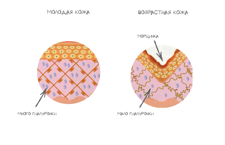 Механизм образования морщин
