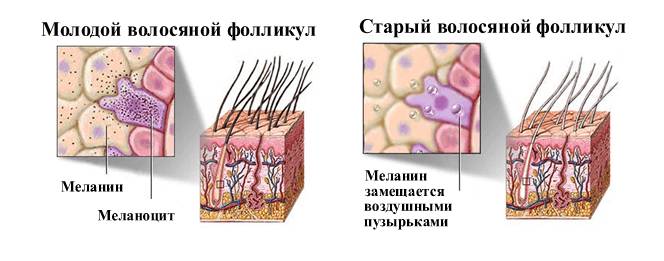 механизм появления седины