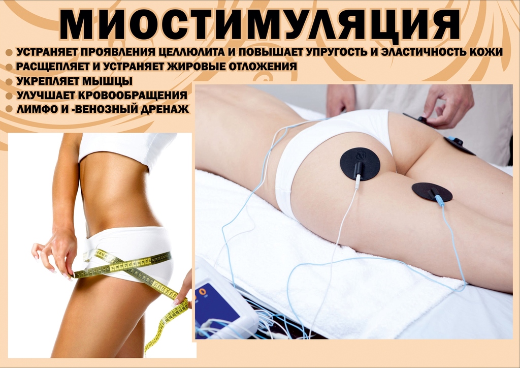 Миостимуляция