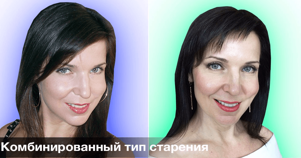 Комбинированный тип старения