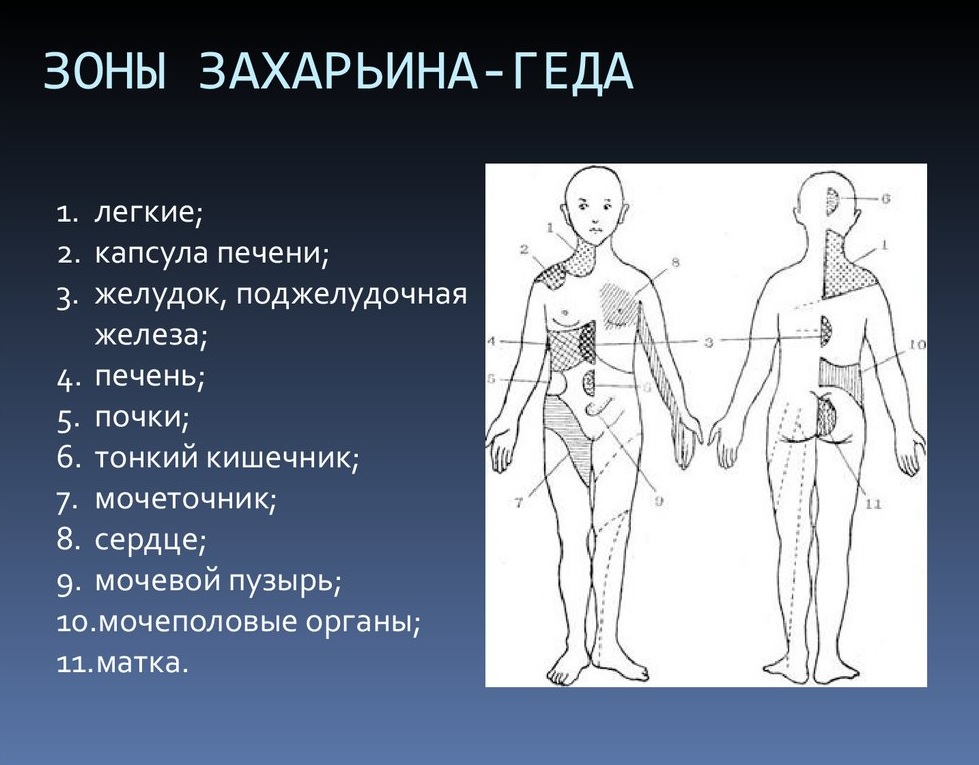 Основные зоны Захарьина-Геда
