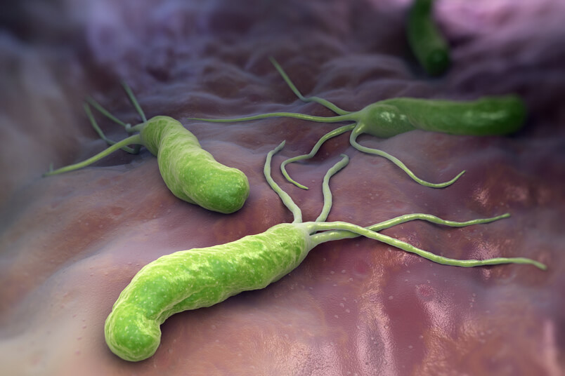Helicobacter Pilori