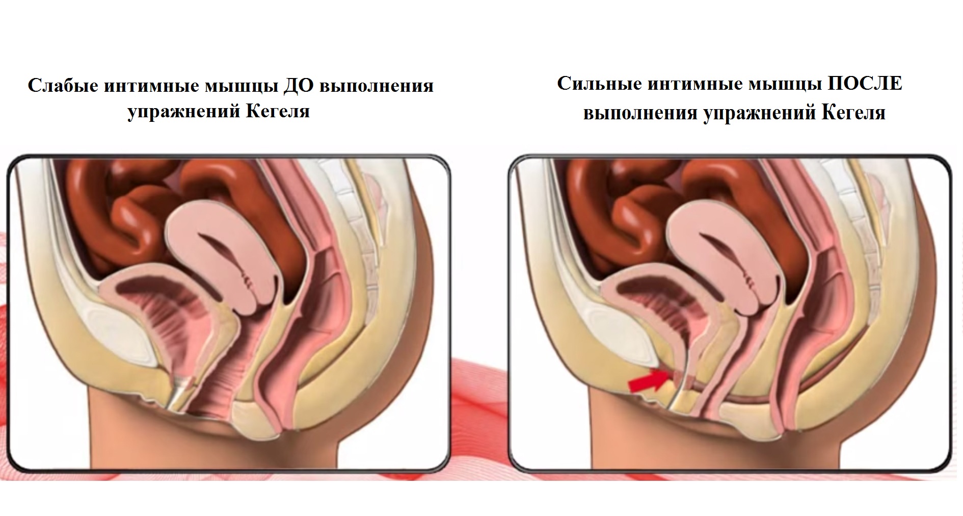 Фото «до» и «после»
