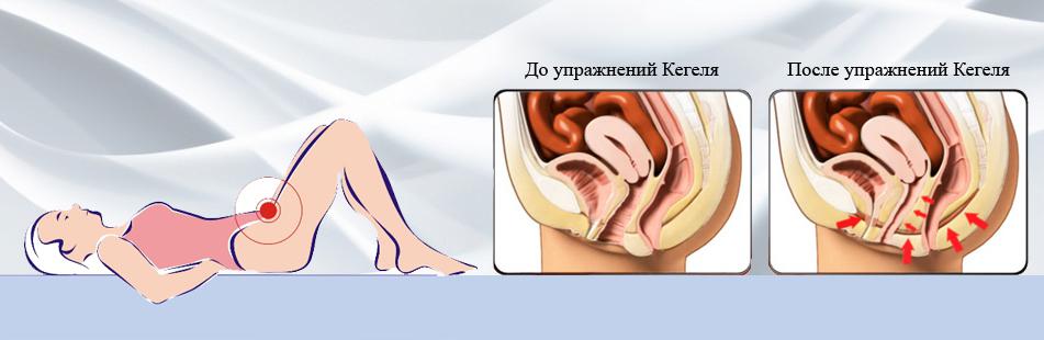 Эффект от занятий с тренажёрами Кегеля