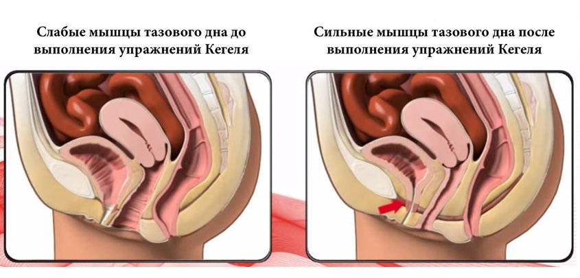 Мышцы до упражнений Кегеля и после