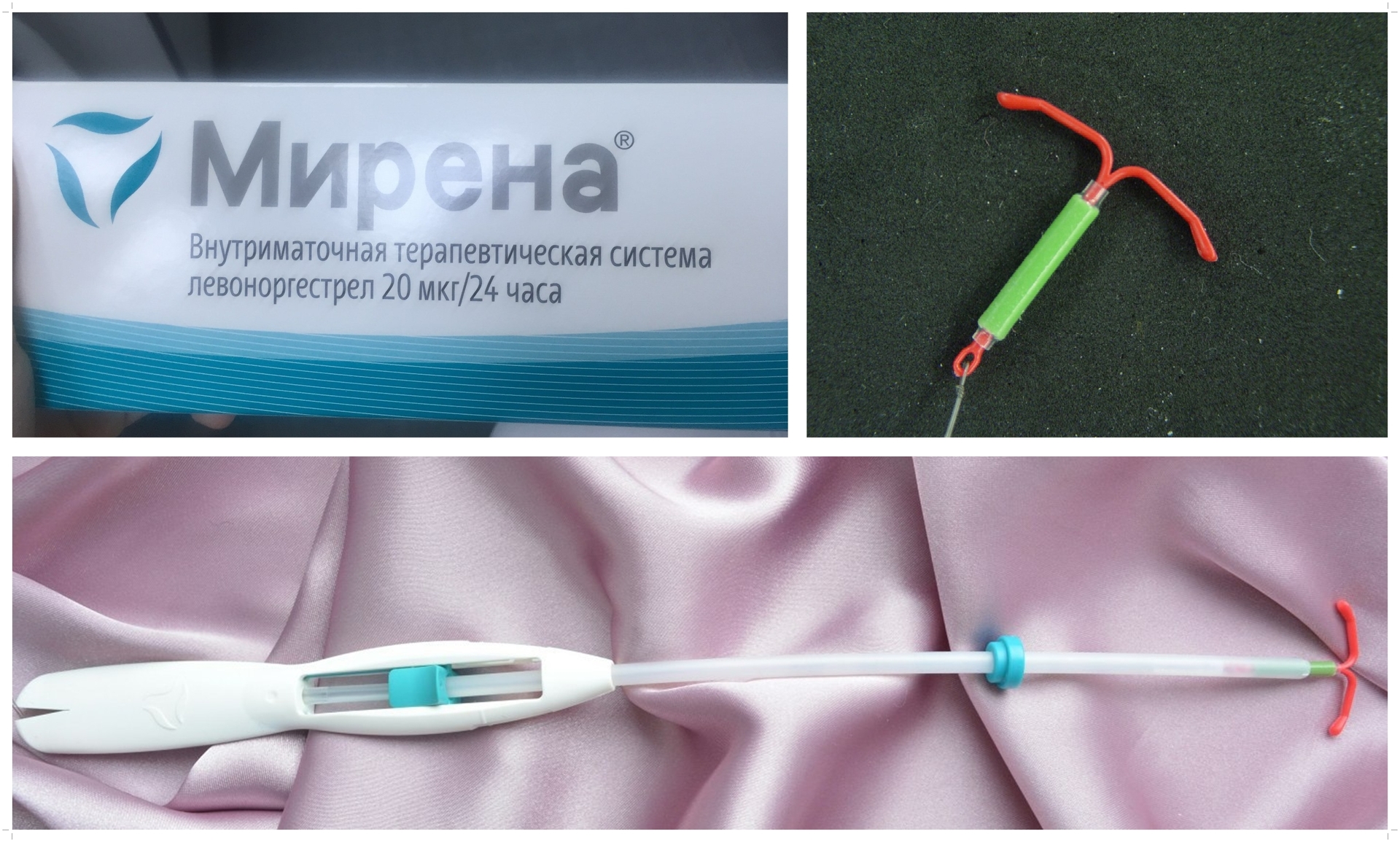 Внутриматочная спираль Мирена