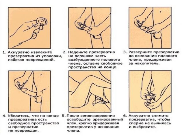Схема использования презерватива