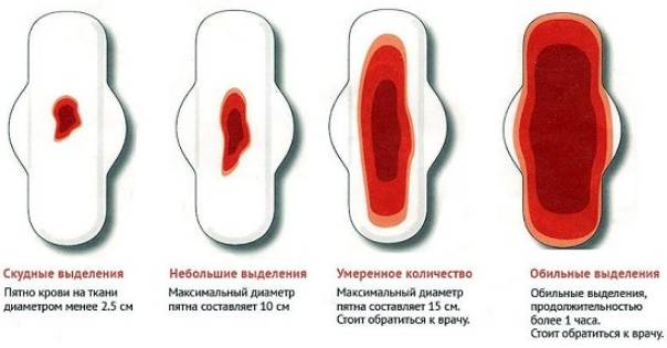 Скудные, умеренные и обычные менструальные выделения (показано на прокладке)