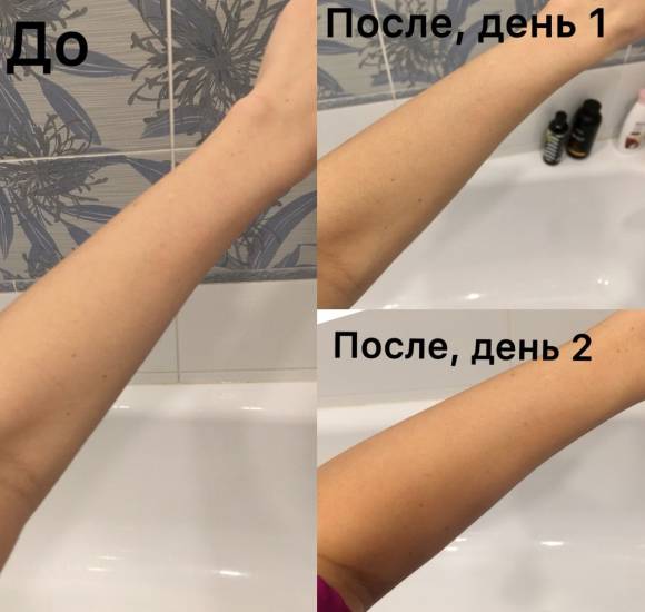 Кожа до и после автозагара