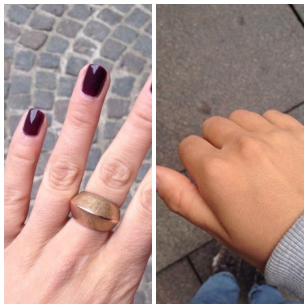 Рука девушки до и после загара при предварительном использовании Веторона