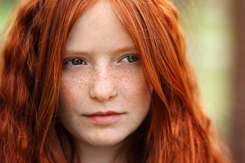 Девушка с первым фототипом кожи