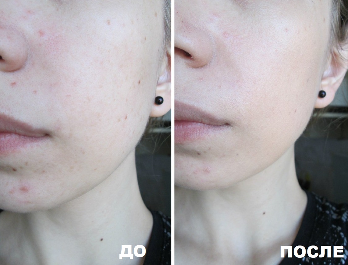 До и после нанесения CC Cream Avon Mark
