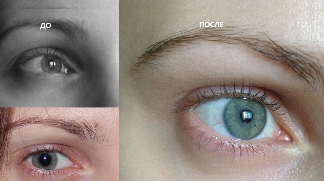 Ресницы