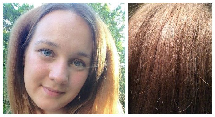 Волосы через полгода после буст ап