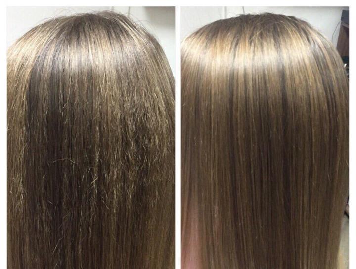 Результат процедуры анти-буст ап