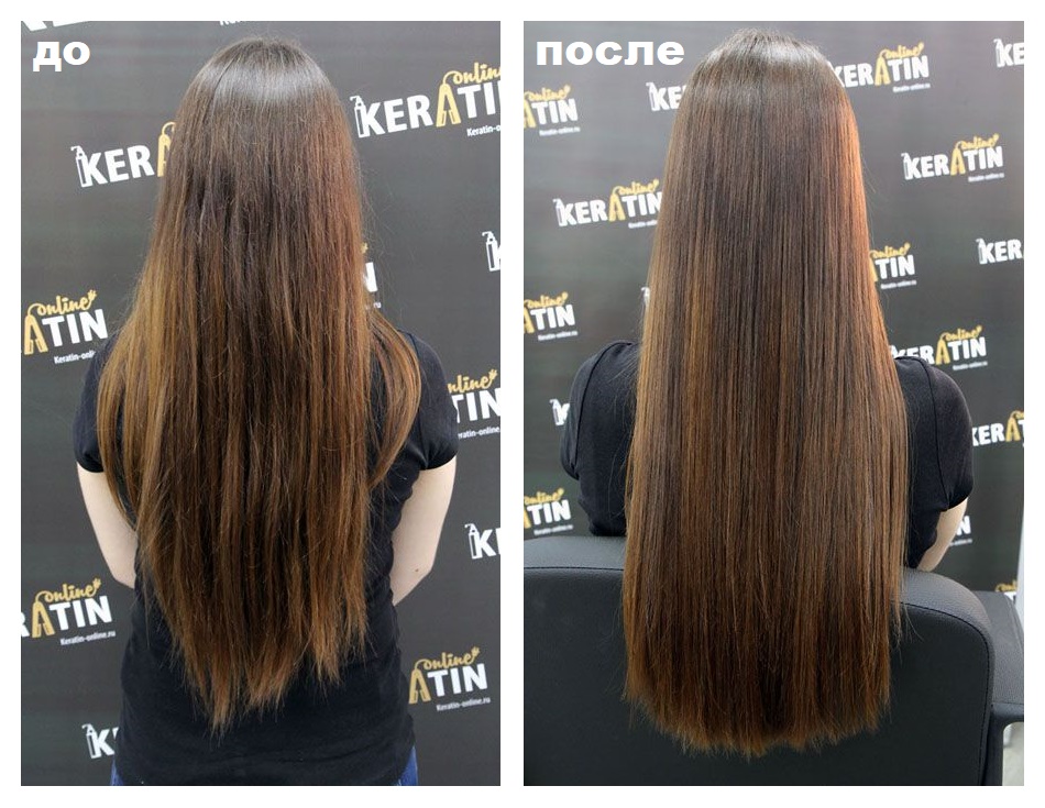 Эффект холодного ботокса на примере продукта Relief HP Firenze