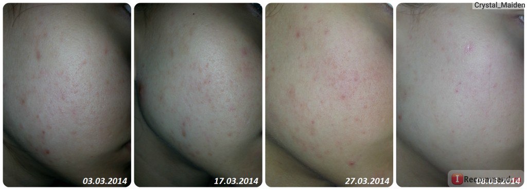 Применение эфирного масла розового дерева