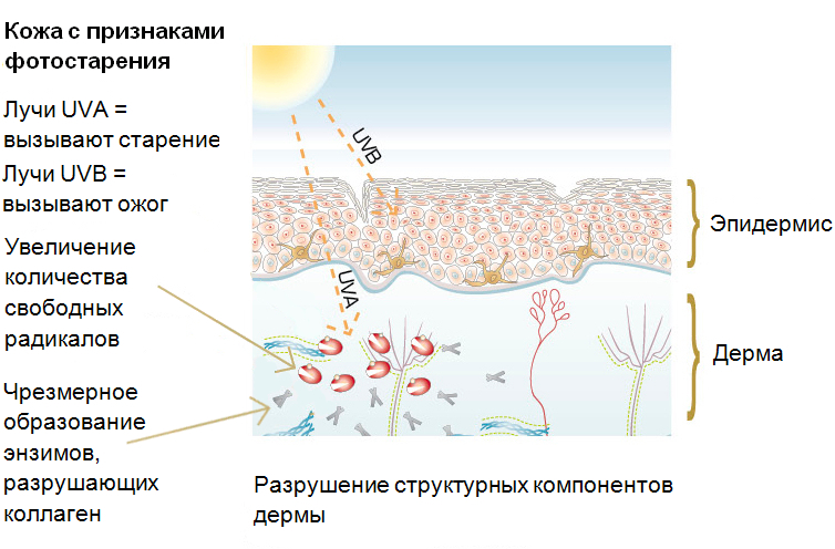 Признаки фотостарения кожи