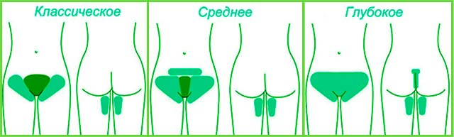 Схема классического, среднего и глубокого бикини