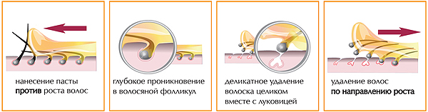 Щадящее удаление волосков