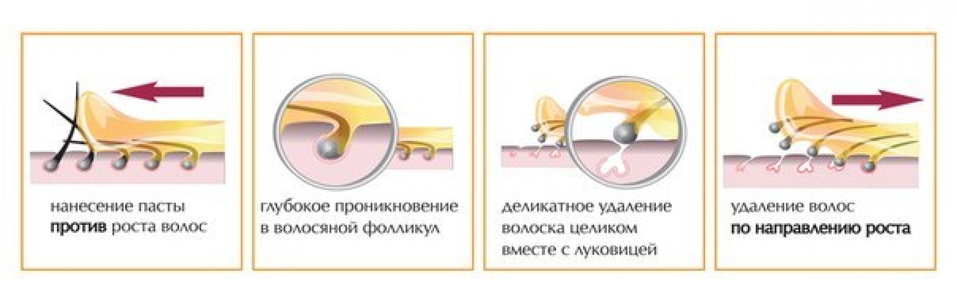 Схема шугаринга