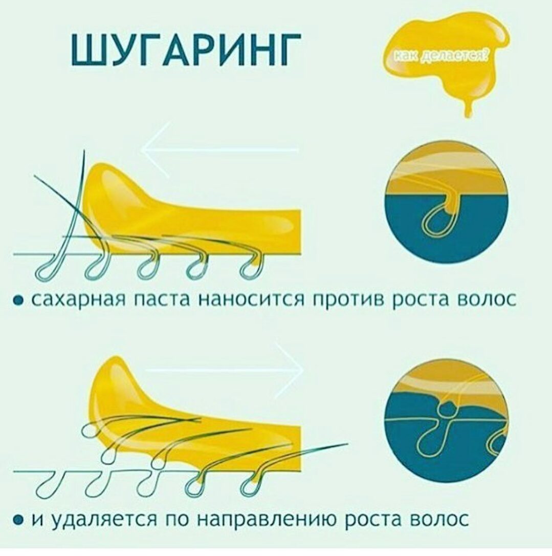 Схема шугаринга