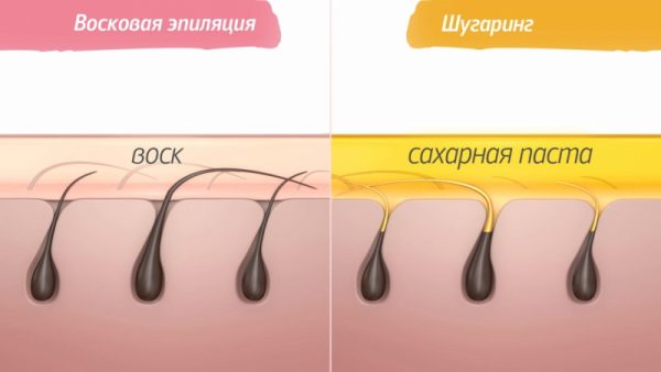 Схема ваксинга и шугаринга
