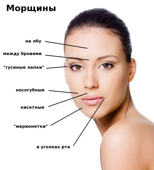 Лицо девушки и схема расположения морщин