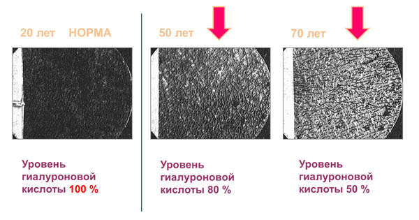 Состояние кожи под микроскопом