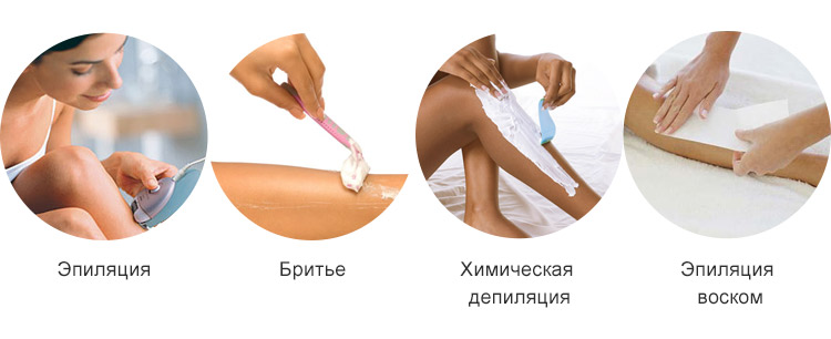 Виды депиляции