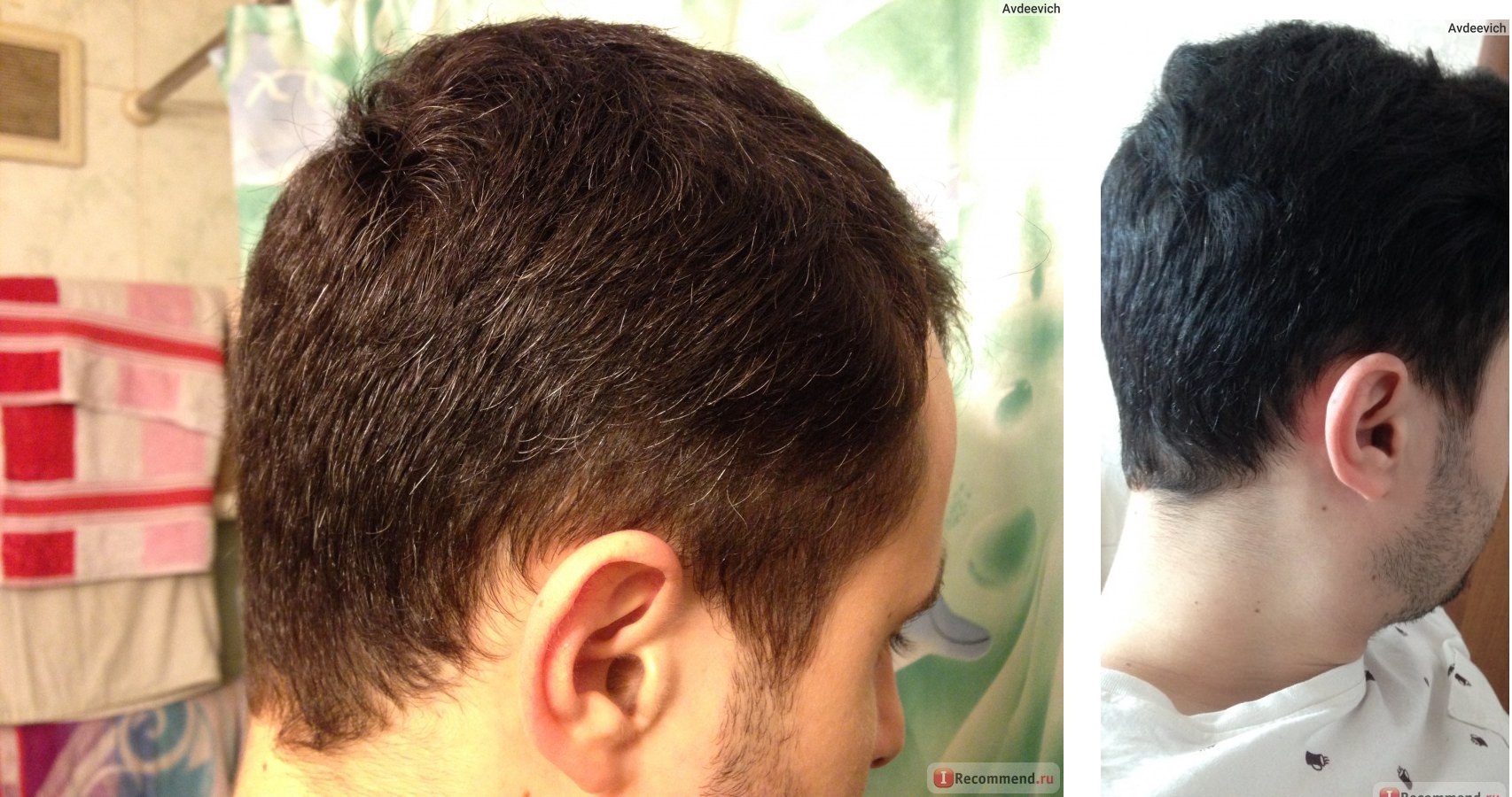 Волосы до и после камуфляжа