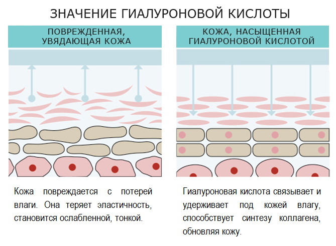 Значение гиалуроновой кислоты