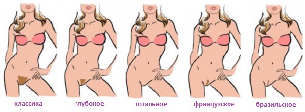 Зоны бикини